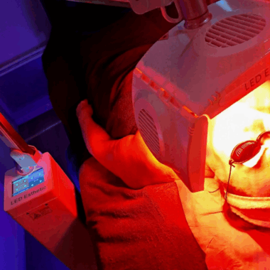 Led esthetic